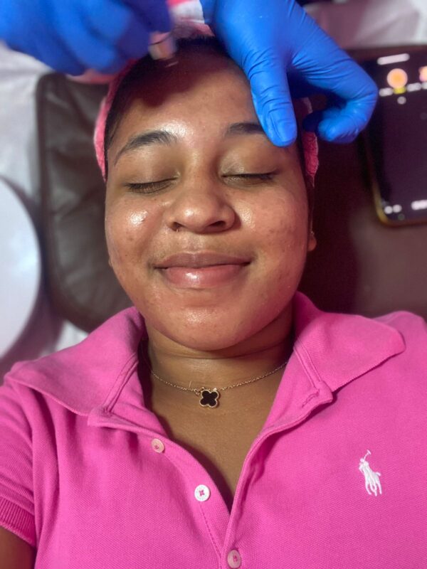 High frequency facials - Image 2