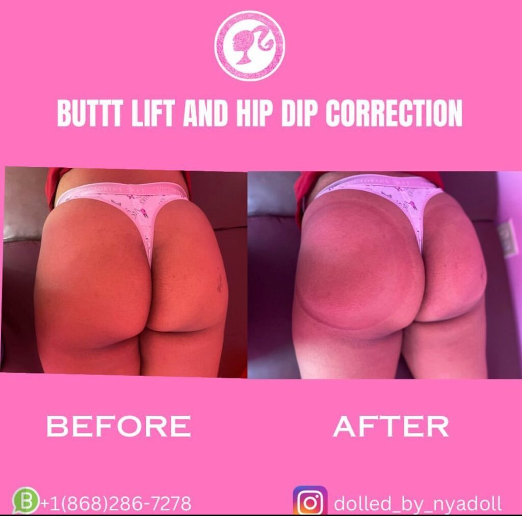 hd-ba4