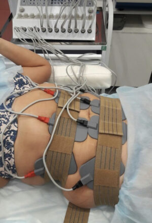 Electric Muscle Stimulation